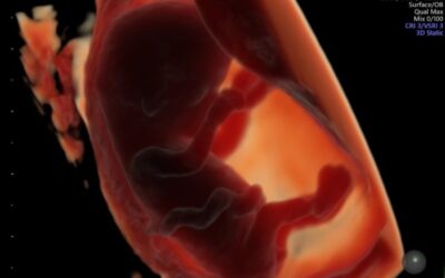 Consumir alimentos ultraprocesados afecta a la fertilidad humana y al desarrollo del feto